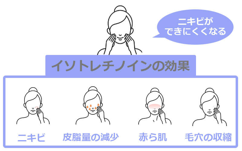 イソトレチノイン