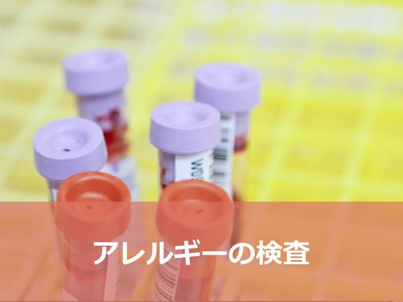 アレルギーの検査