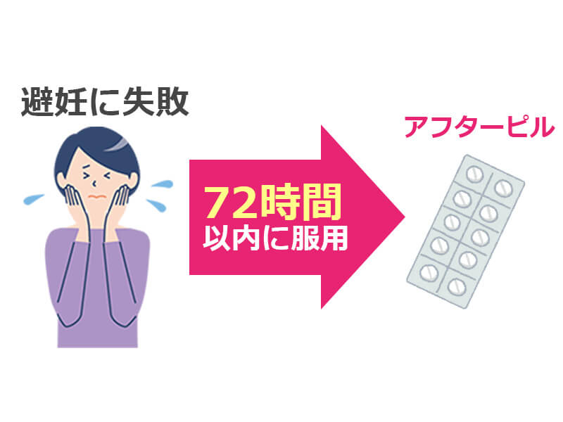 アフターピル
