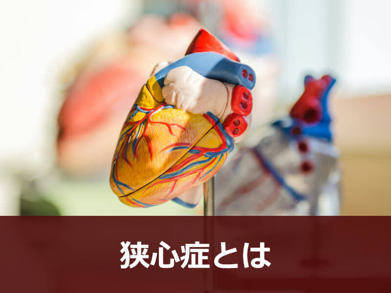 狭心症とは