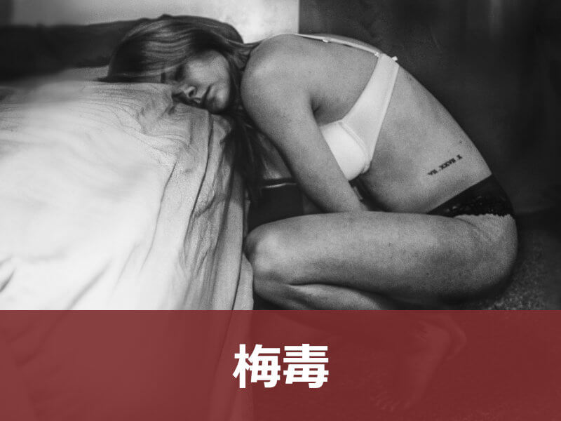 梅毒
