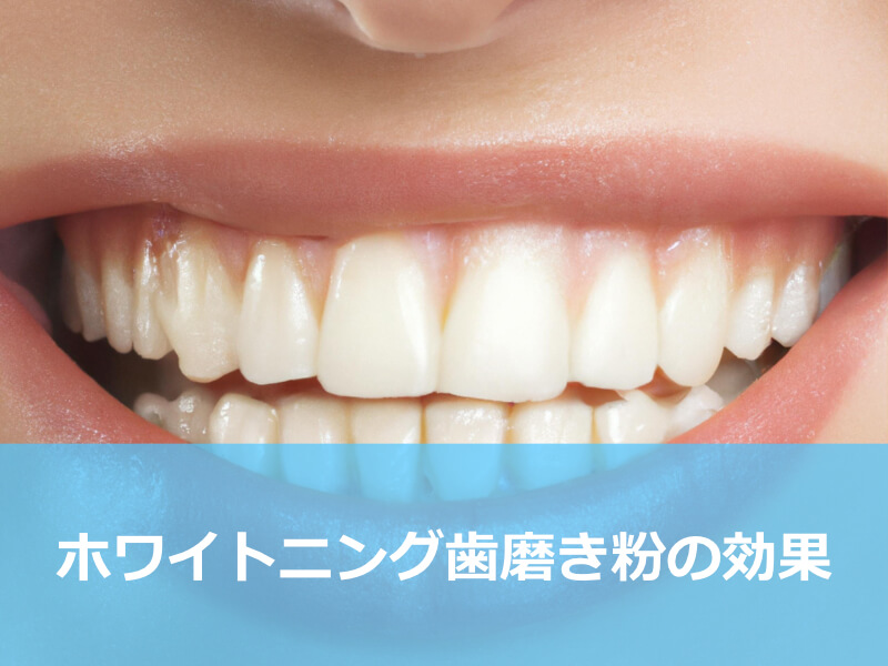ホワイトニング歯磨き粉の効果