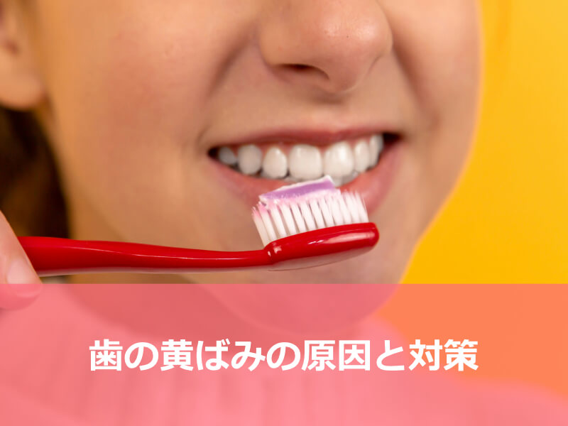 歯の黄ばみの原因と対策