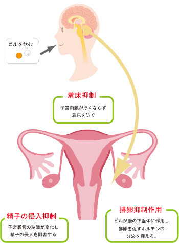 マーベロンの効果