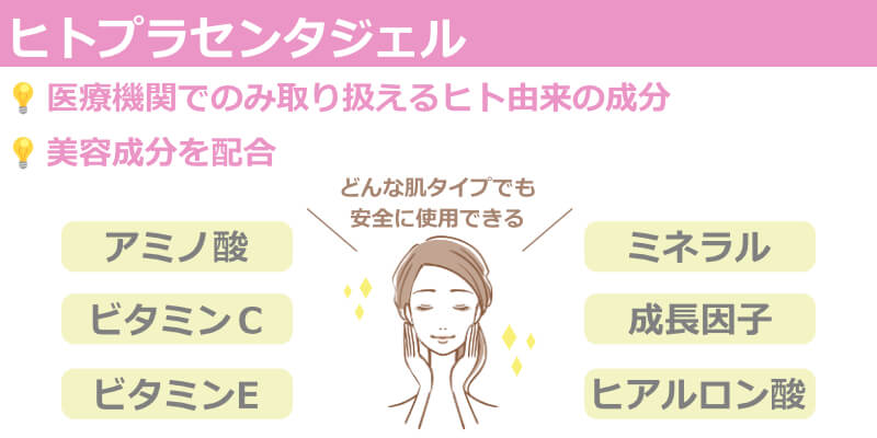 特徴