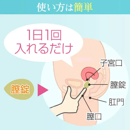 ヴァギシン膣錠